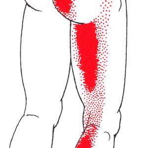 Exercises For Sciatica Pain Treatment - How To Use Massage Techniques For Sciatica Pain Relief