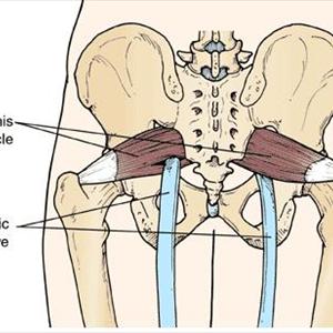 Sciatica Symptom - Suffering With Herniated Disc Problems? 5 Ways To Relieve Your Back Pain Now