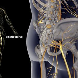 Arthritis Rhuematoid Sciatica Treatment - Does Sciatica Scare You? Do You Need To Be Scared, Find Out Here...
