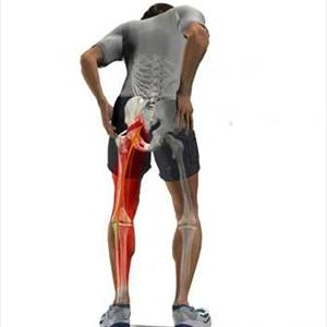 Sciatica Cures - Sciatica Treatment By Physiotherapists